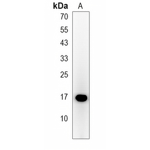 HMGN3 Rabbit Polyclonal Antibody