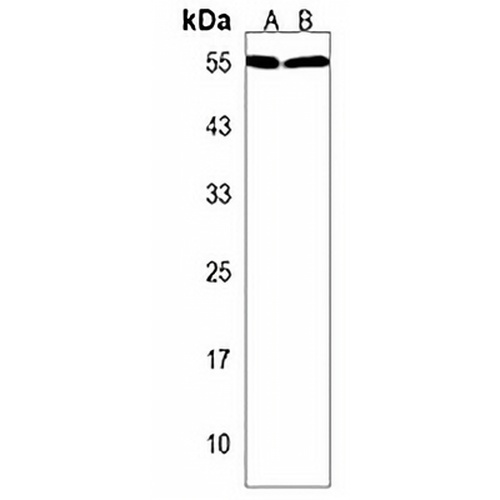USP27X Rabbit Polyclonal Antibody