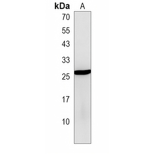 PTTG2 Rabbit Polyclonal Antibody