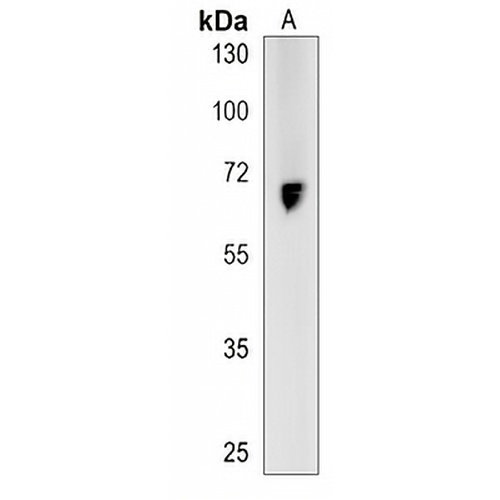 TNIP1 Rabbit Polyclonal Antibody