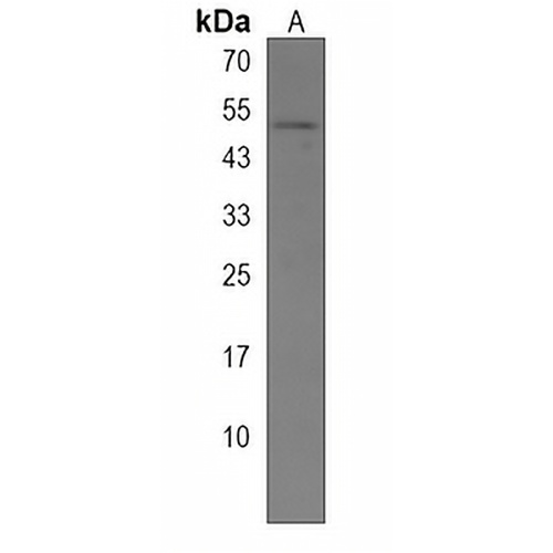 VPAC2 Rabbit Polyclonal Antibody
