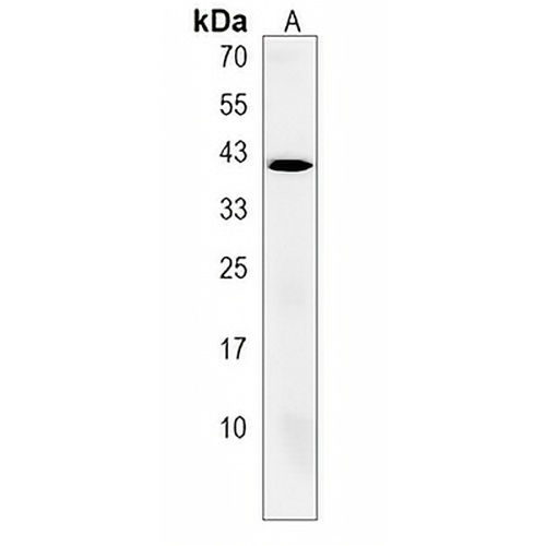 RGS11 Rabbit Polyclonal Antibody