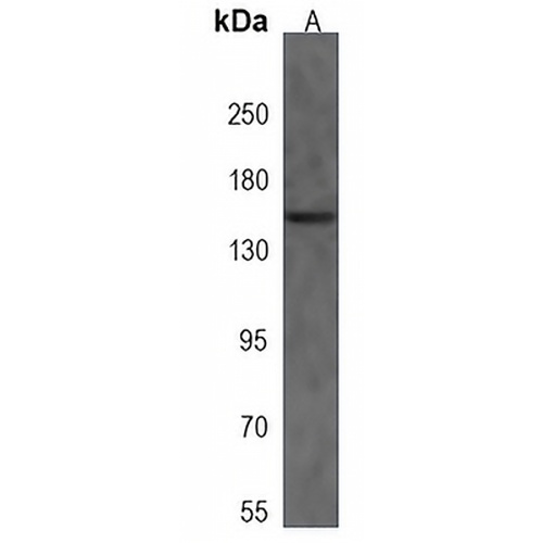 NCAPG2 Rabbit Polyclonal Antibody