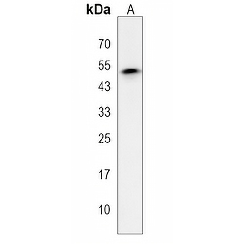 P2Y6 Rabbit Polyclonal Antibody