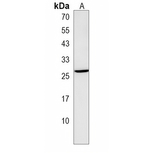TRAT1 Rabbit Polyclonal Antibody