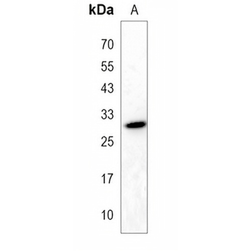 EPDR1 Rabbit Polyclonal Antibody