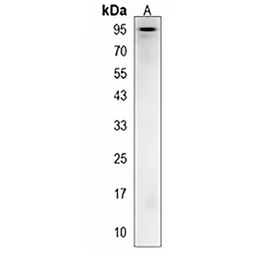 AP4B1 Rabbit Polyclonal Antibody