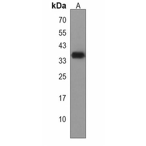 SBK2 Rabbit Polyclonal Antibody