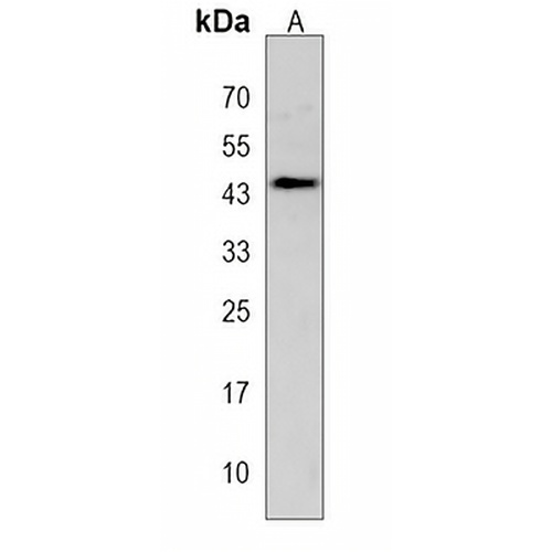 IER5 Rabbit Polyclonal Antibody