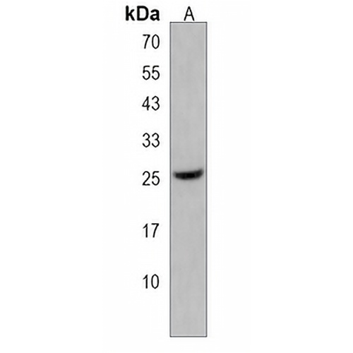 HMGN5 Rabbit Polyclonal Antibody