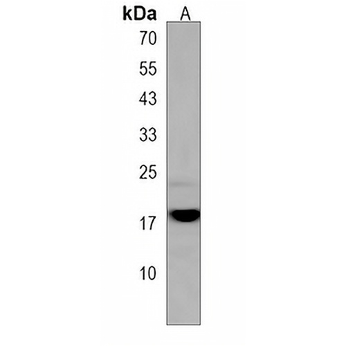 CACFD1 Rabbit Polyclonal Antibody