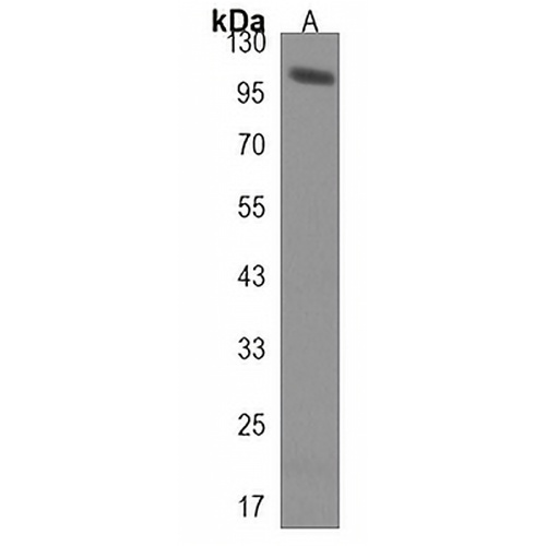 HECTD3 Rabbit Polyclonal Antibody