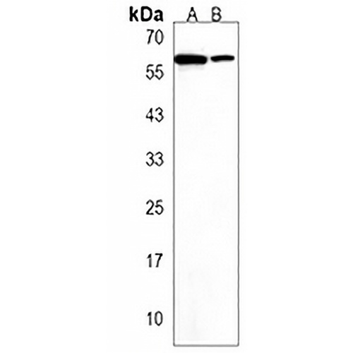 ZBTB22 Rabbit Polyclonal Antibody