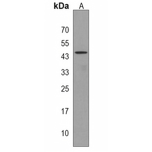MTRF1 Rabbit Polyclonal Antibody