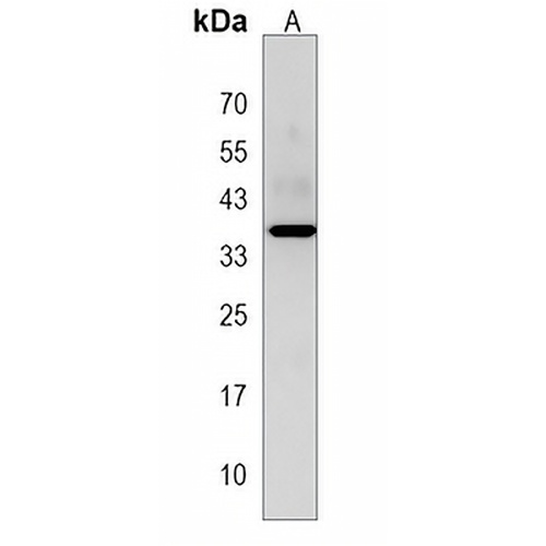 PBLD Rabbit Polyclonal Antibody