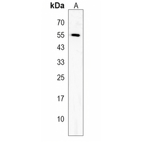 FBXW9 Rabbit Polyclonal Antibody