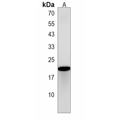 DNAJC5G Rabbit Polyclonal Antibody