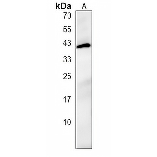 SNX21 Rabbit Polyclonal Antibody