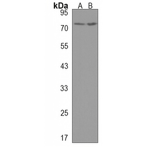 CCIN Rabbit Polyclonal Antibody
