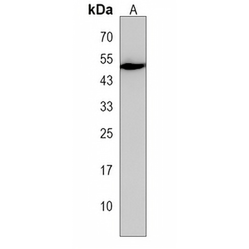 IKBIP Rabbit Polyclonal Antibody
