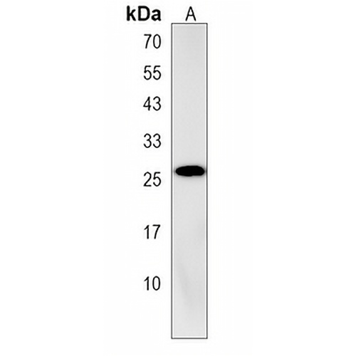 AIDA Rabbit Polyclonal Antibody