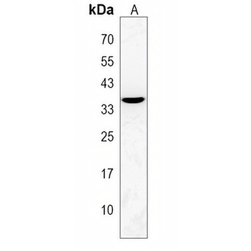 OR2L8 Rabbit Polyclonal Antibody