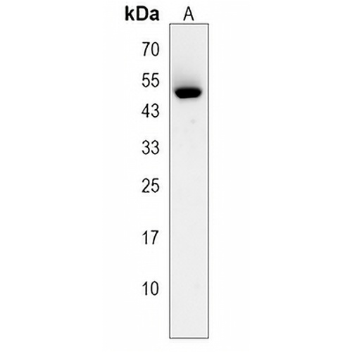 Kir2.2 Rabbit Polyclonal Antibody