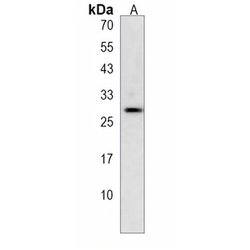CLEC9A Rabbit Polyclonal Antibody