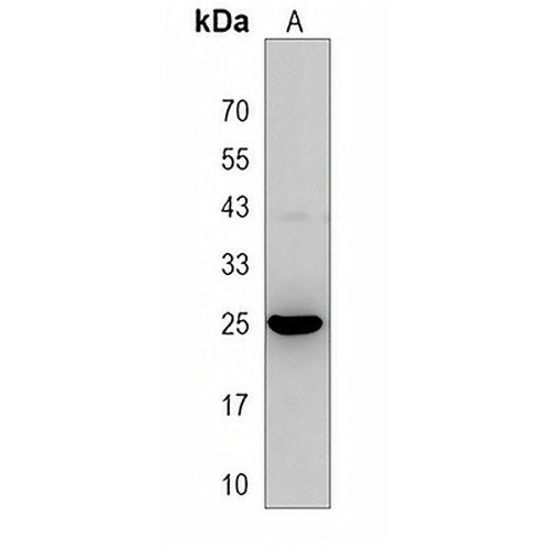 MOSPD3 Rabbit Polyclonal Antibody