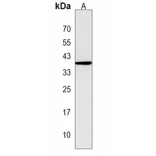 MTHFSD Rabbit Polyclonal Antibody