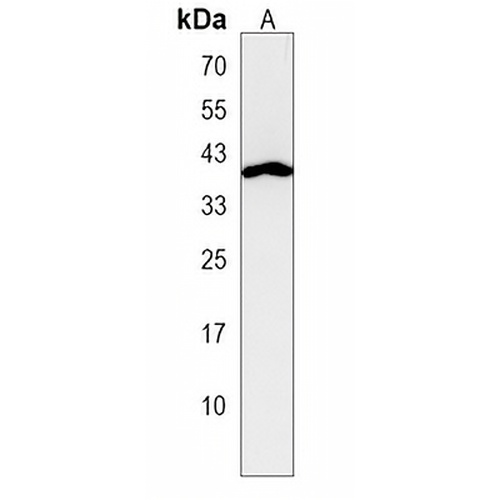 VPS37C Rabbit Polyclonal Antibody