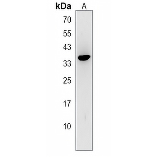 WBP2NL Rabbit Polyclonal Antibody