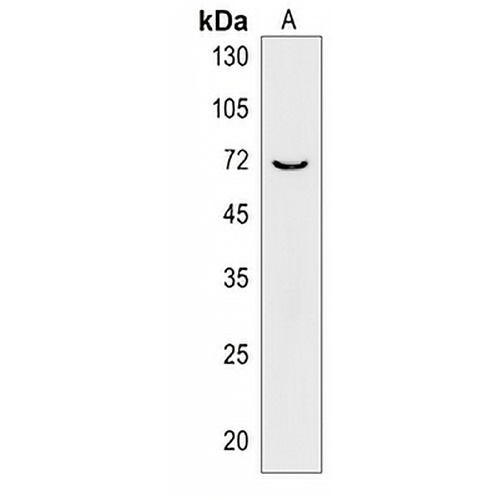 ZNF613 Rabbit Polyclonal Antibody