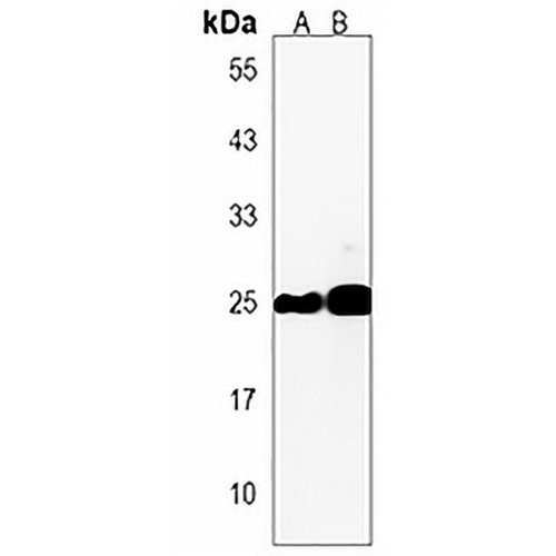 HMGB4 Rabbit Polyclonal Antibody