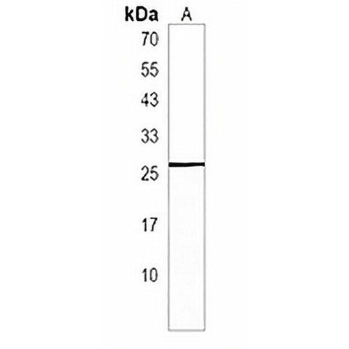 NXNL1 Rabbit Polyclonal Antibody