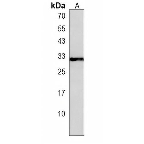 CELA1 Rabbit Polyclonal Antibody