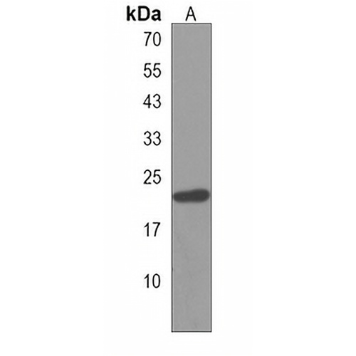 HOXB6 Rabbit Polyclonal Antibody