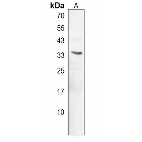 HOXD9 Rabbit Polyclonal Antibody