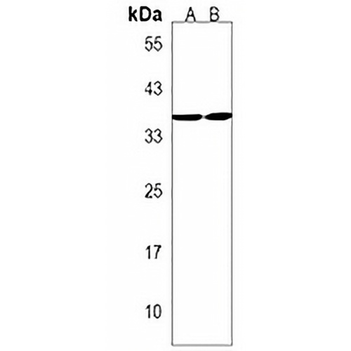RQCD1 Rabbit Polyclonal Antibody