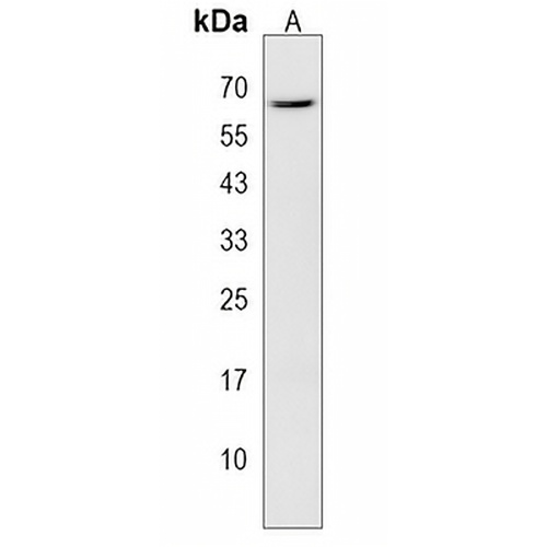 CECR6 Rabbit Polyclonal Antibody