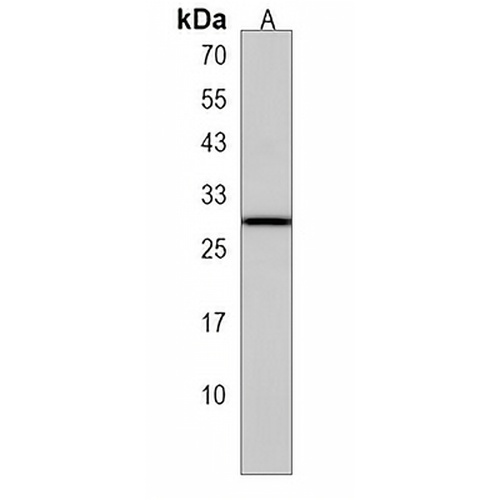 CGB2 Rabbit Polyclonal Antibody