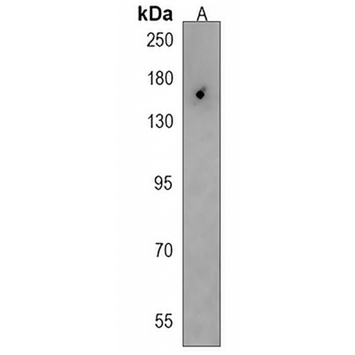 RIP140 Rabbit Polyclonal Antibody
