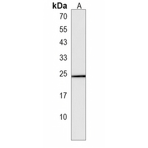 ECSCR Rabbit Polyclonal Antibody