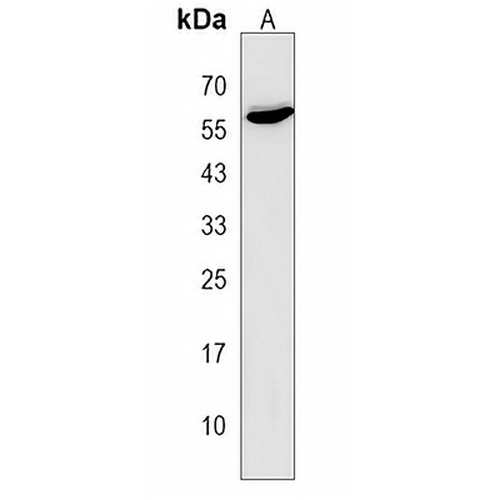 ONECUT3 Rabbit Polyclonal Antibody