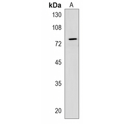 CRTAC1 Rabbit Polyclonal Antibody
