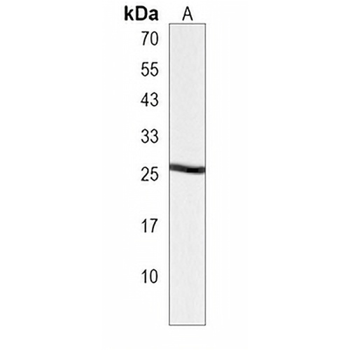 MRGBP Rabbit Polyclonal Antibody