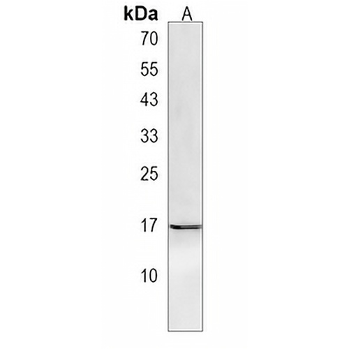 GLIPR2 Rabbit Polyclonal Antibody