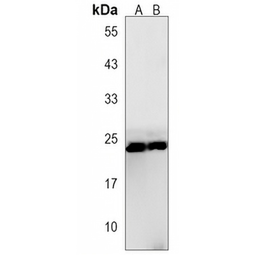 RGS19 Rabbit Polyclonal Antibody