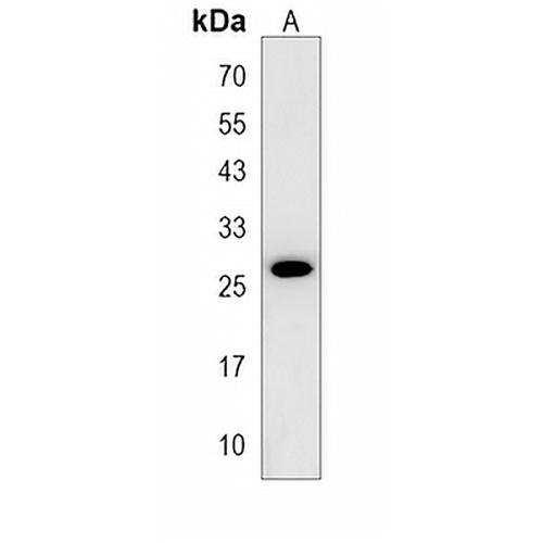 CIDEC Rabbit Polyclonal Antibody