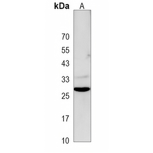 DRAM1 Rabbit Polyclonal Antibody